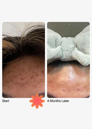 Topicals Mini/Travel Size Faded Serum for Dark Spots & Discoloration