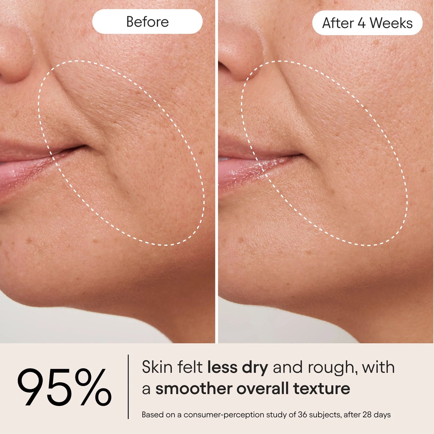 Alpyn Beauty Mini/Travel Size Melt Moisturizer with Bakuchiol and Squalane