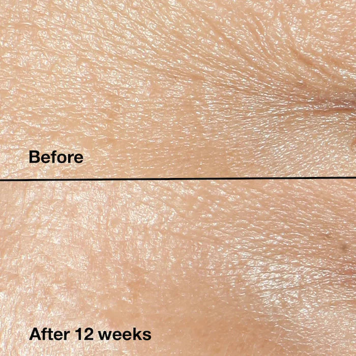 CLINIQUE Mini/Travel Size Smart Clinical Repair™ Wrinkle Correcting Cream