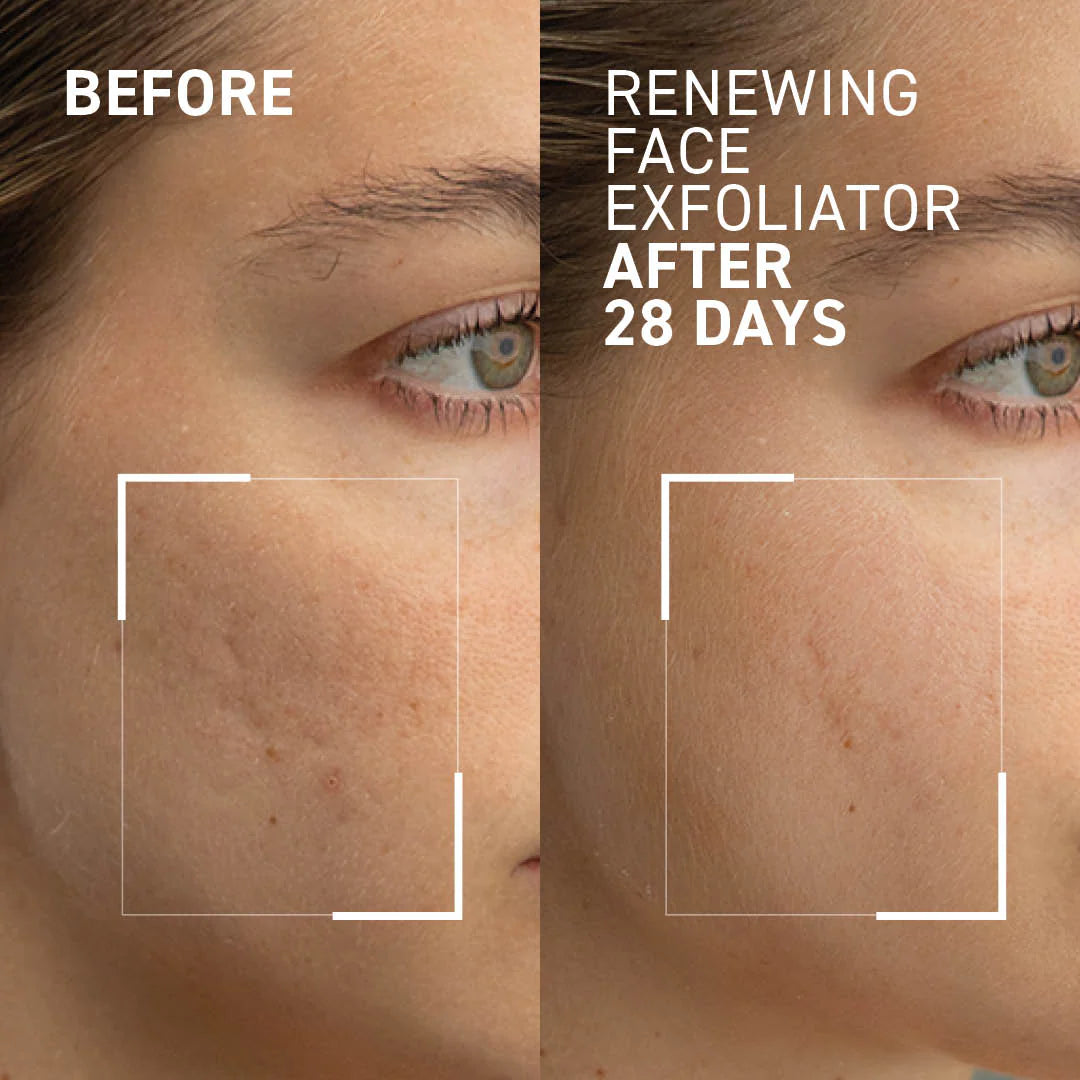 Dr. Brandt Skincare Mini/Travel Size Microdermabrasion Renewing Age-Defying Face Exfoliator