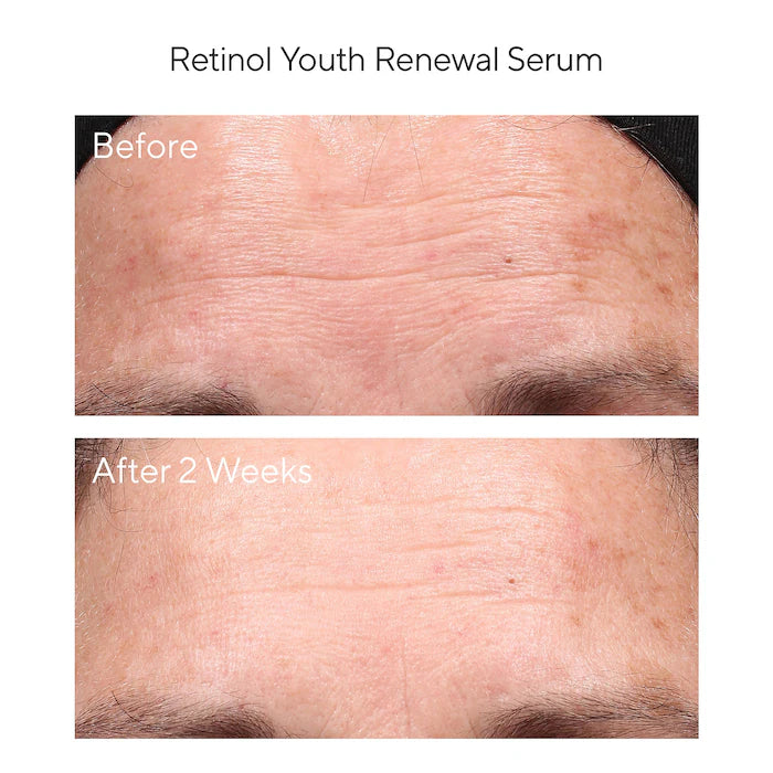 Murad Mini/Travel Size Retinol Youth Renewal Serum